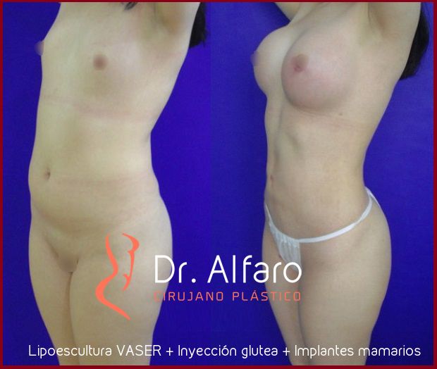 Carlos Gerardo Alfaro Moreno-18