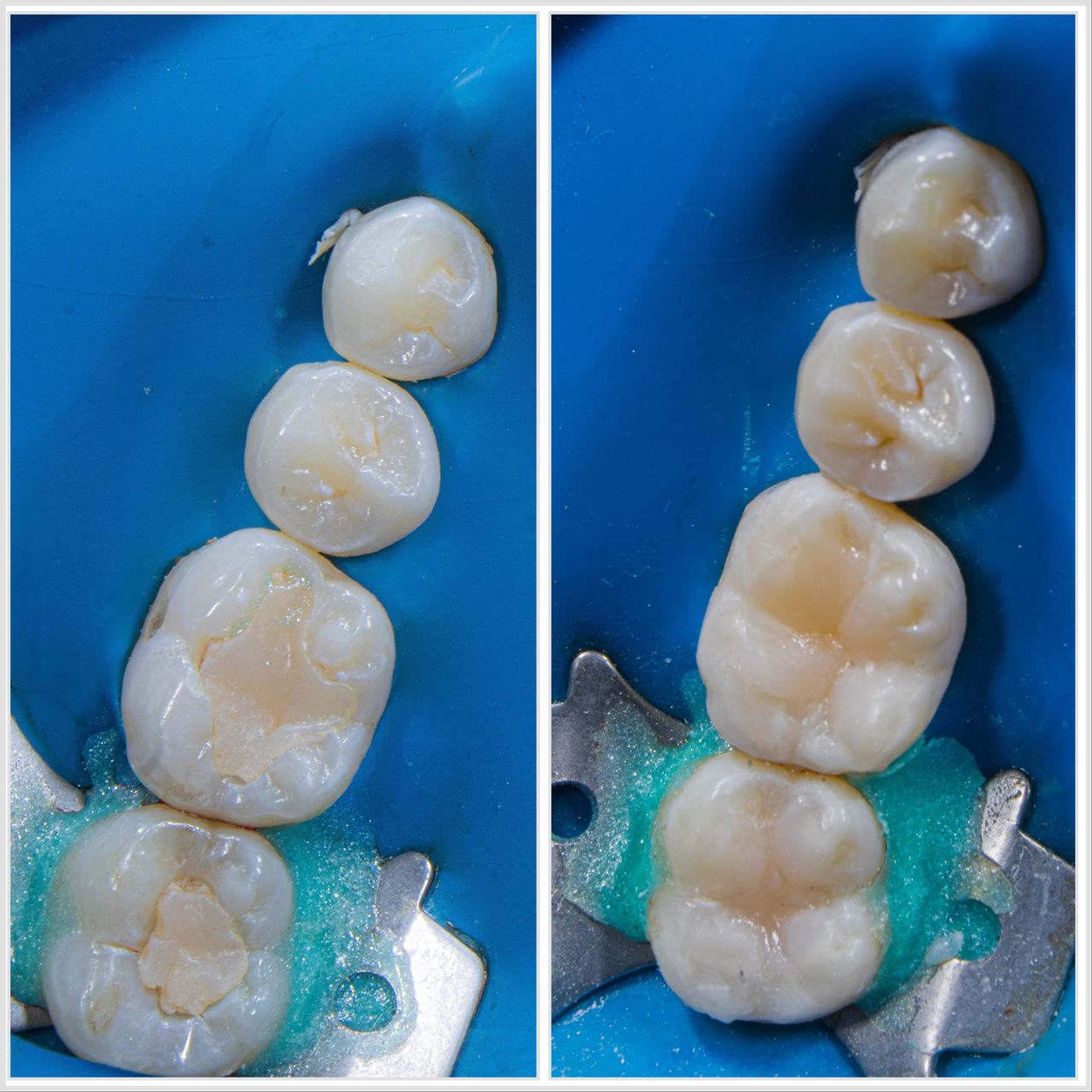 Hervin Eduardo Mendez Borrego-3