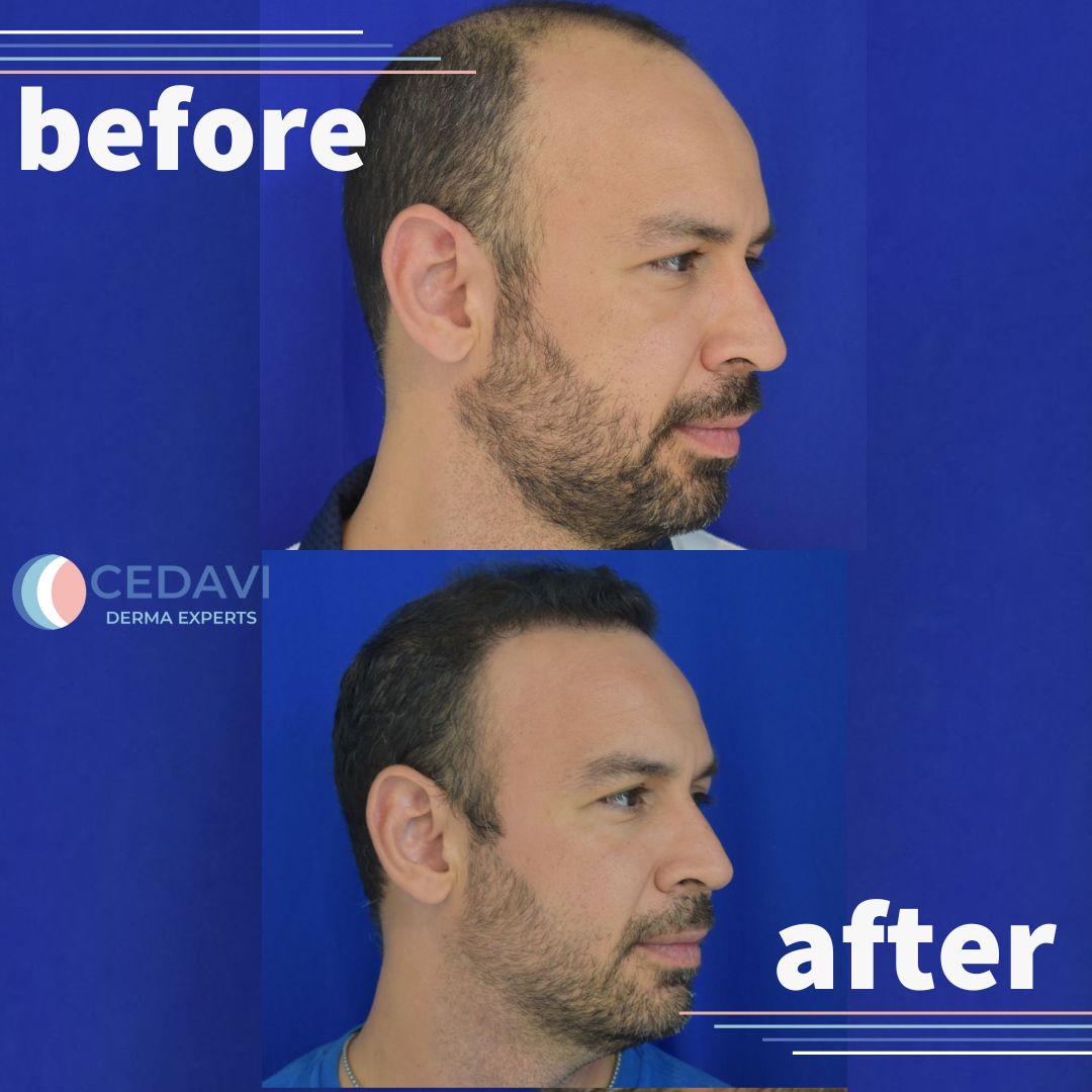 César Daniel Villarreal Villarreal-3