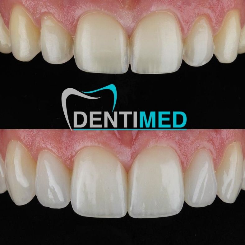 Glenda Sofía Coronado García-12