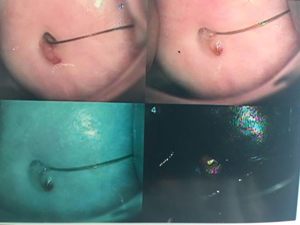 Alfredo Mendez Samano-19