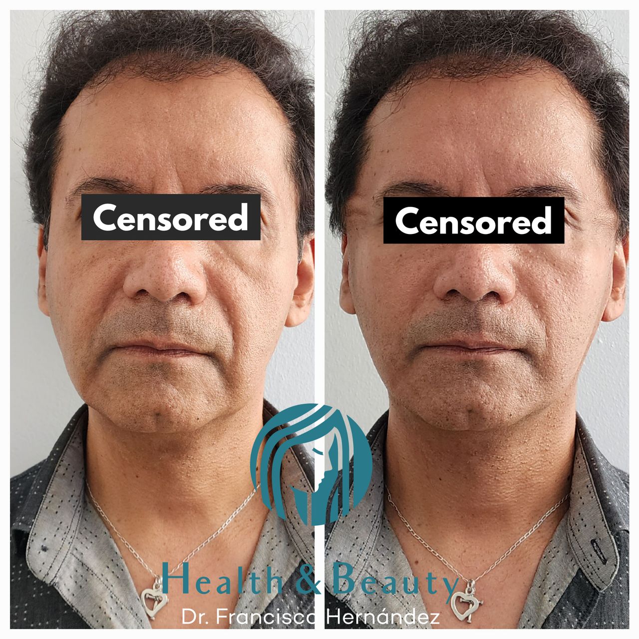 Francisco Hernández Gómez Crespo-46