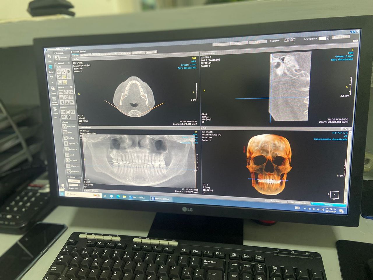 Joaquin Moguel Del Rivero-6