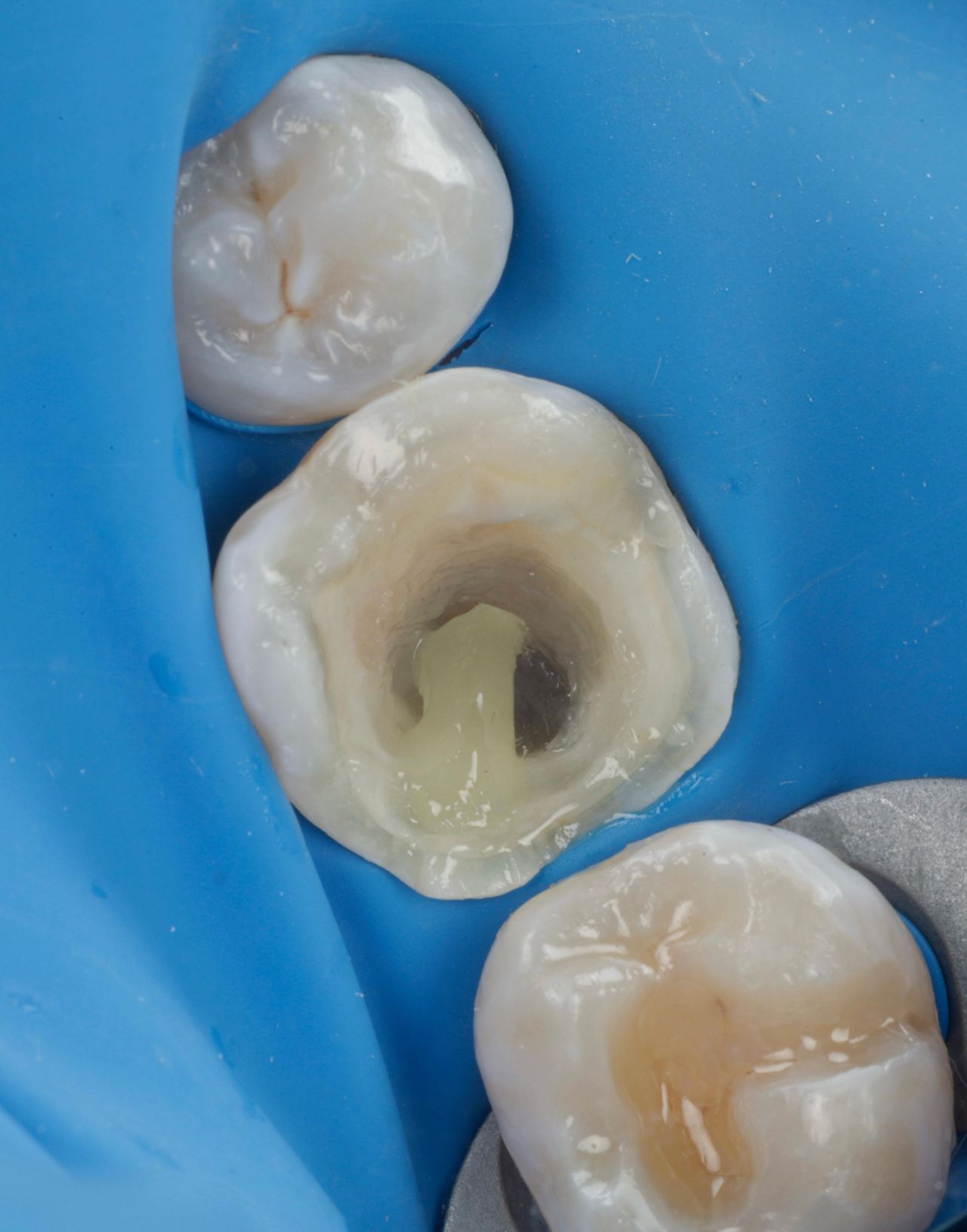 Fredy Alejandro Roblero Gónzalez-47