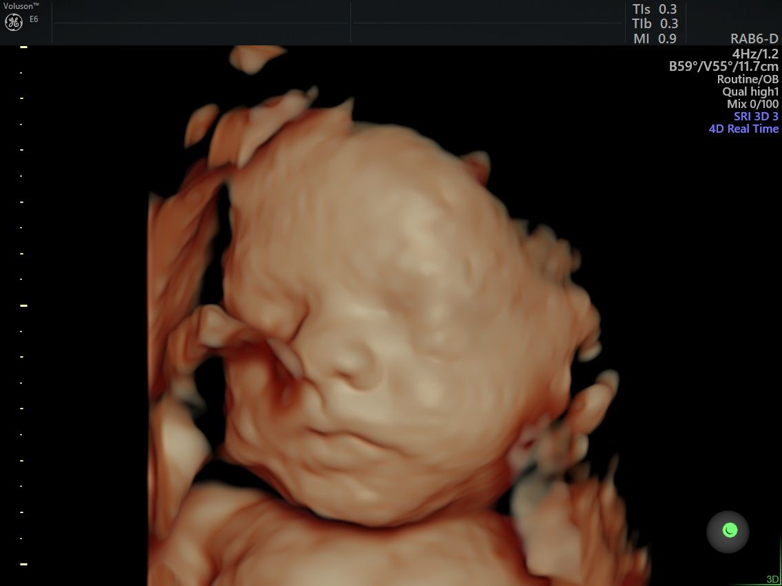 Edgardo Reyes Ponce-8