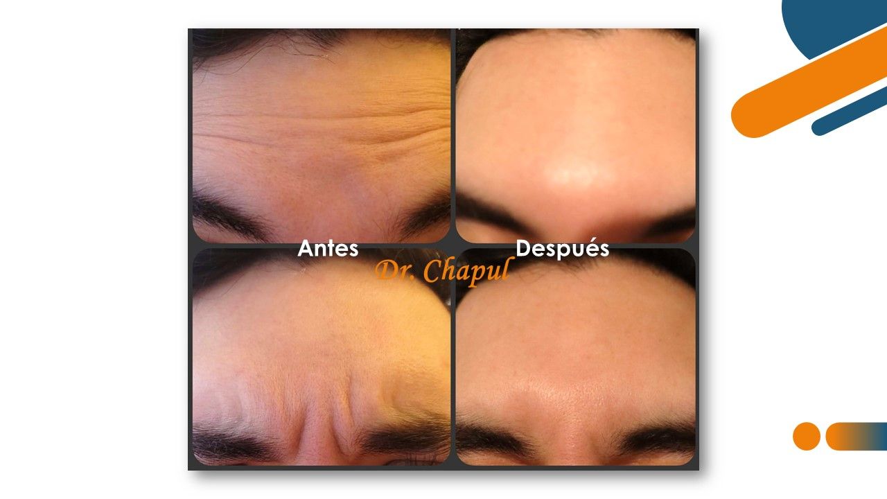 José Luis Muñoz Chapul-21