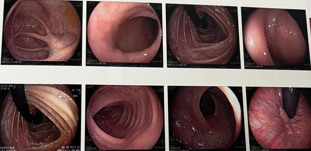 Luis Alberto Revuelta Rodriguez-2