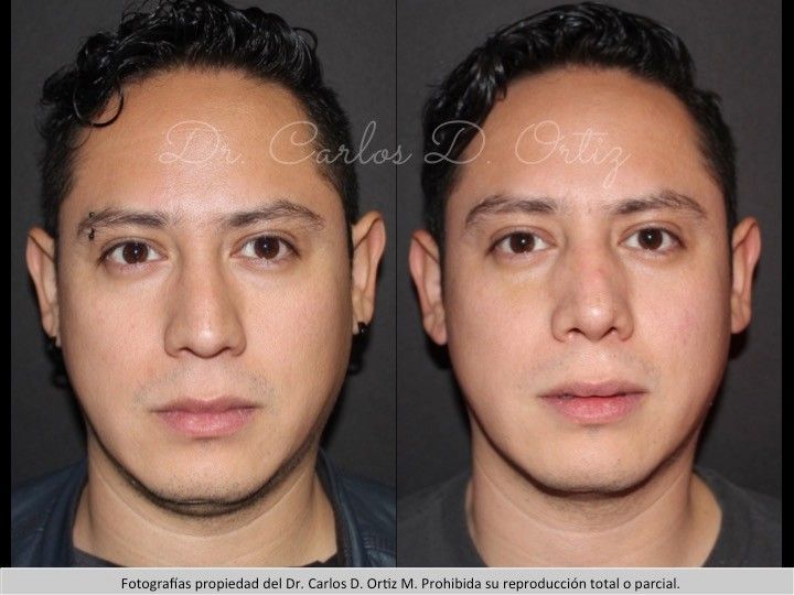 Carlos David Ortiz Moreno-4