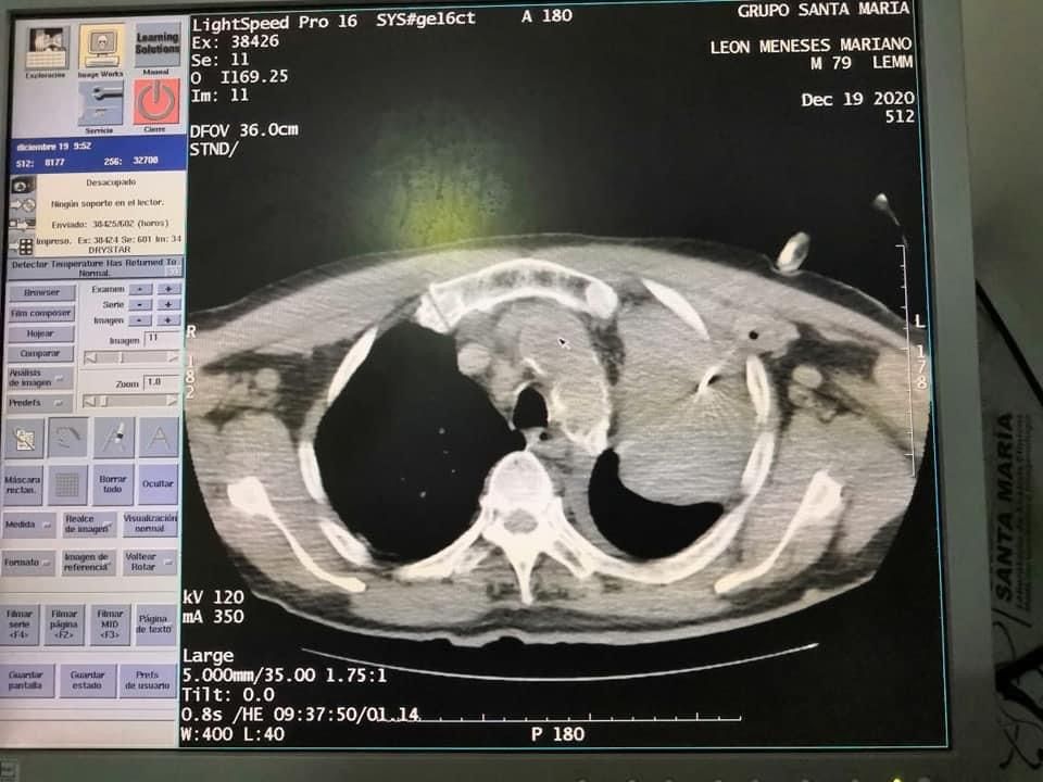 Carlos Gómez Guzmán-7