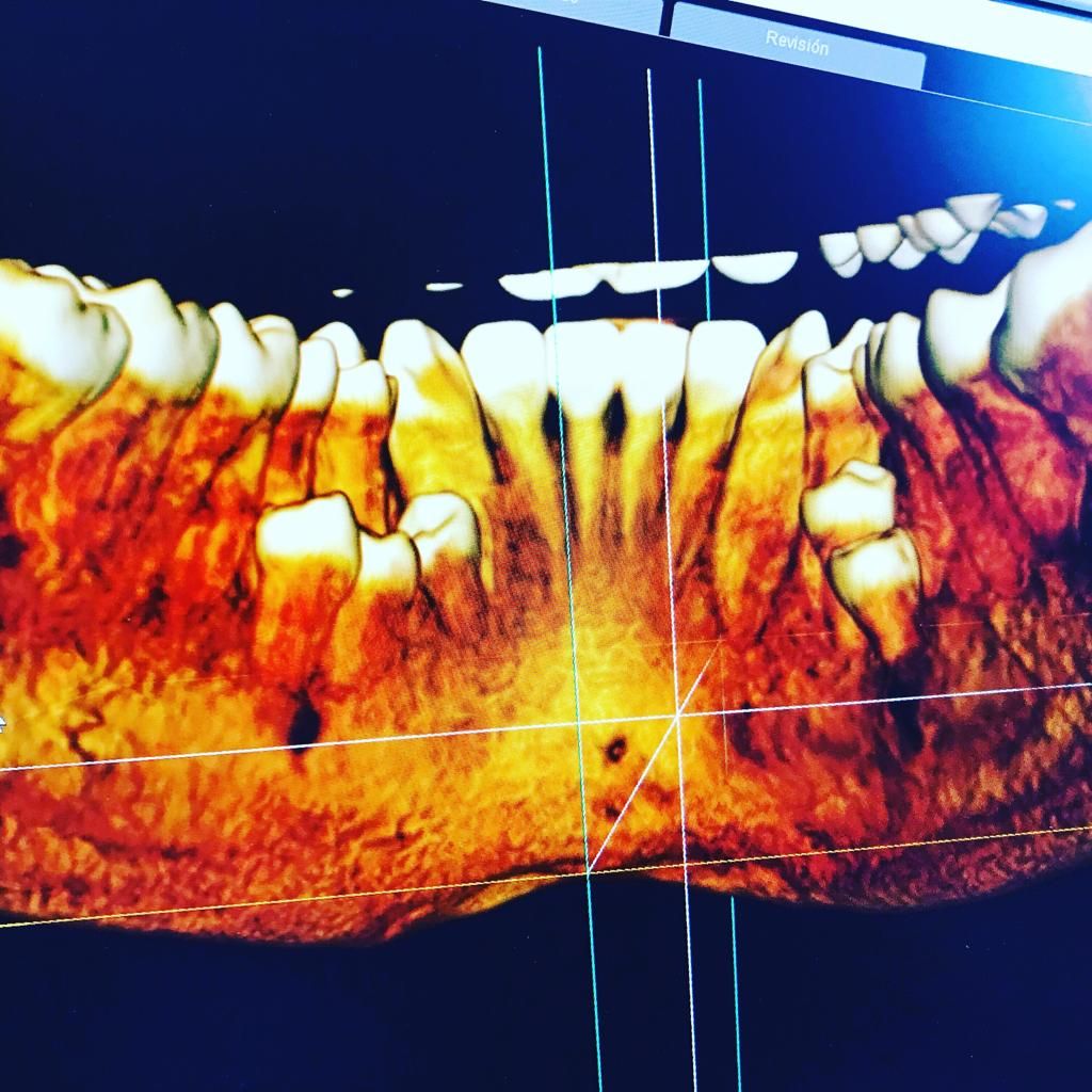 Miguel Tapia Ruiz-24