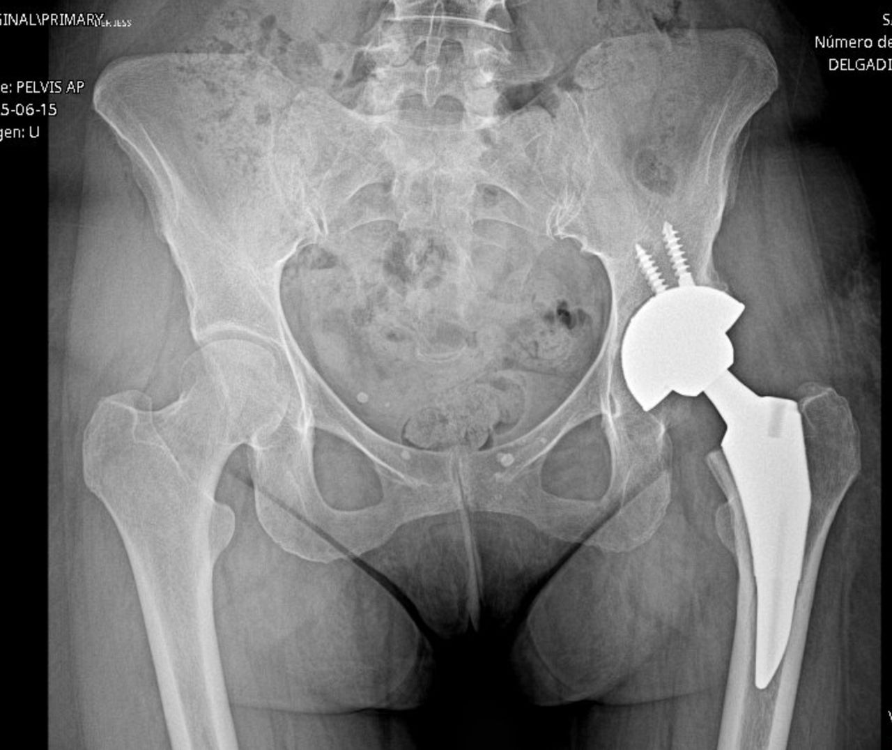 Jorge Manuel Valadez Soto-14