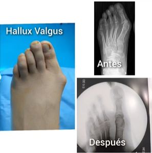 Abraham Flores Flores-1