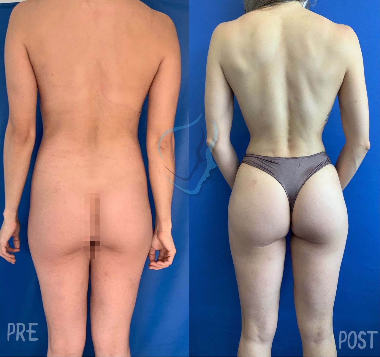 Giuseppe Tanzillo-29