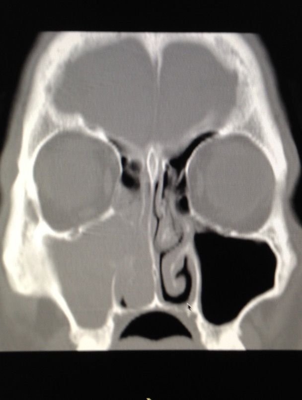 Eduardo Ivan Acuña Ramirez-8