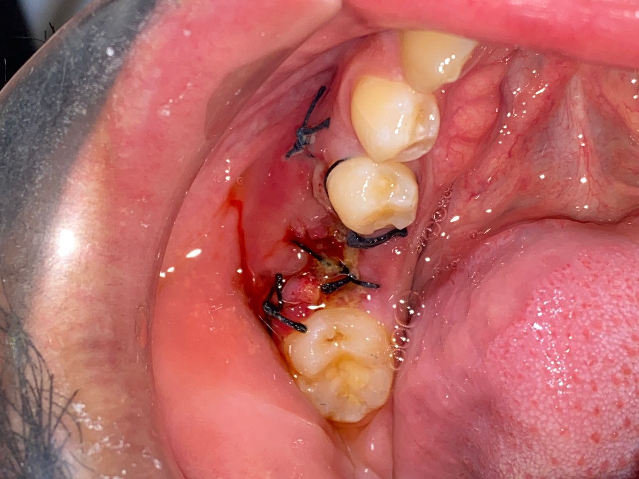 Raúl Méndez Cifuentes-16