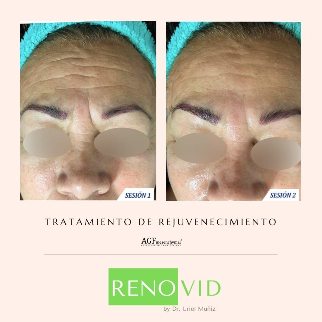 Teófilo Uriel Muñiz Chávez-50