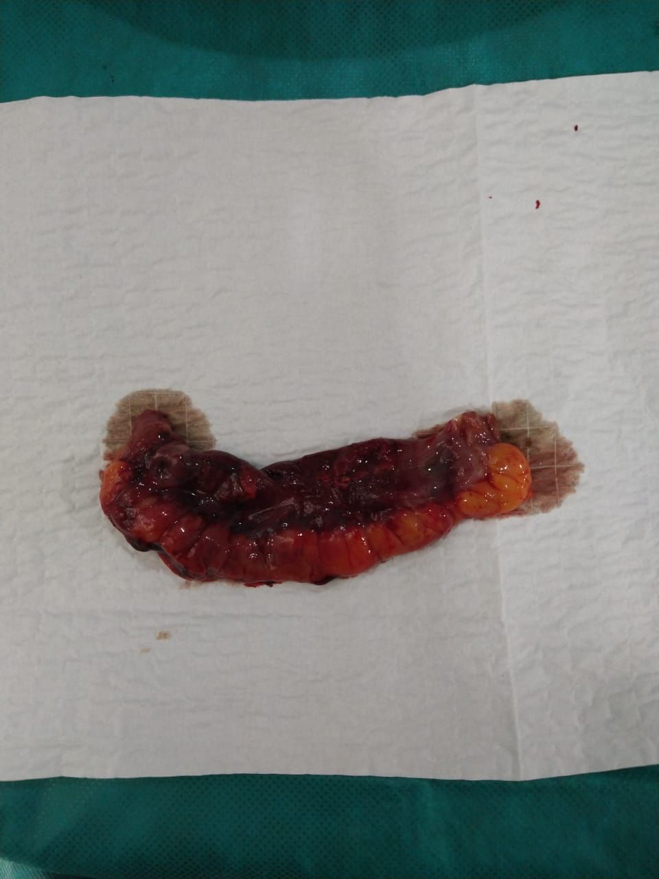 Luis Angel Medina Andrade-20