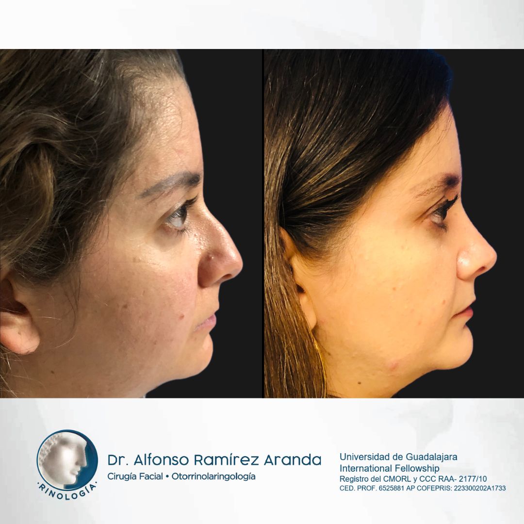 Alfonso Ramírez Aranda-20