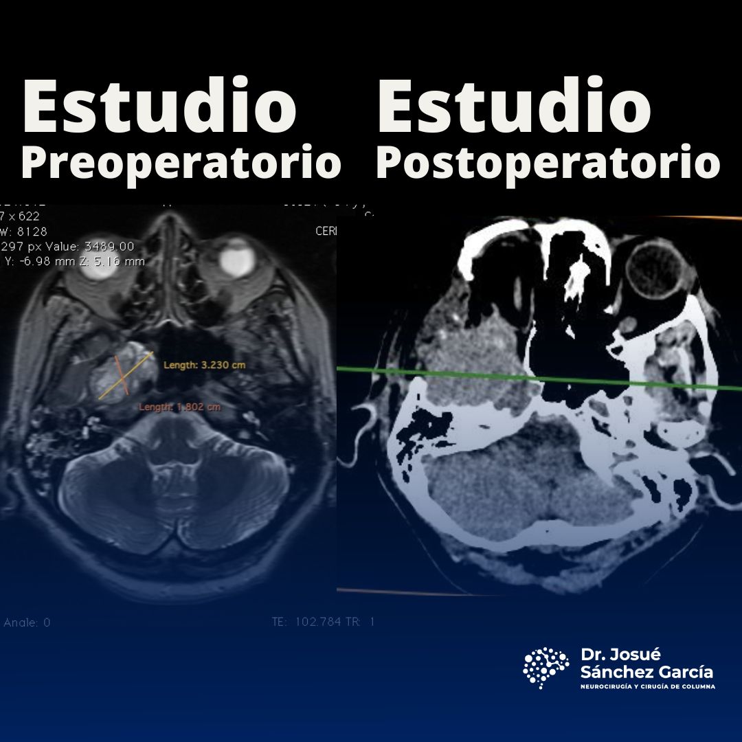 Josué Sánchez García-2