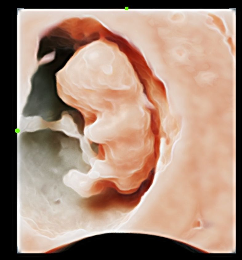 Luis Lagarde Campos-0