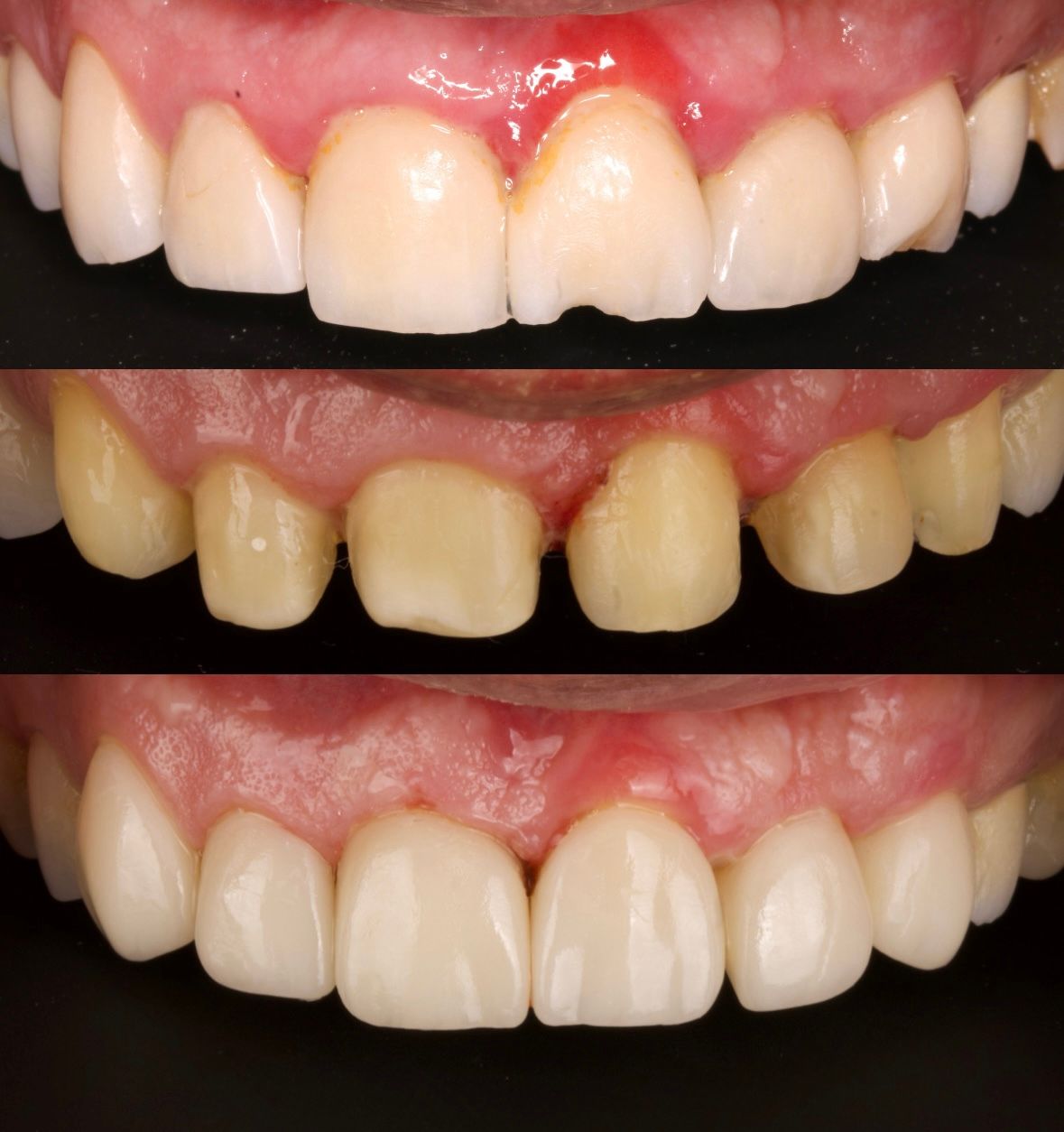 Miguel Alberto Escalona Mora-3