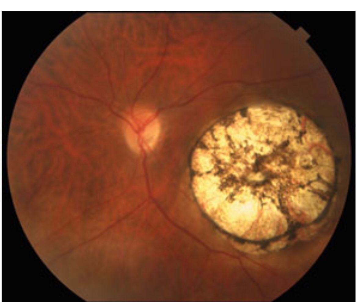 Isela Partida Pulido-12