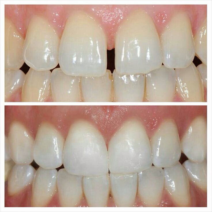 Gloria Haydee Castillo Castellanos-11