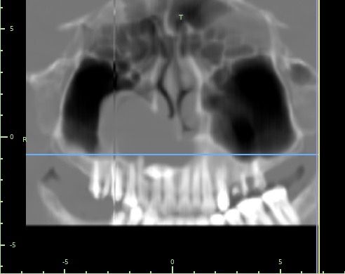 Marco Antonio Martinez Vasquez-7