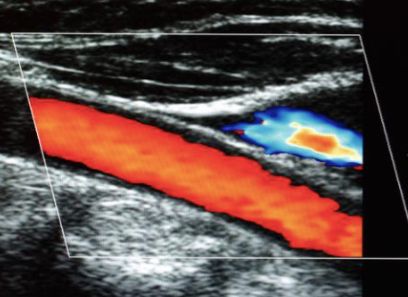 Alfredo Velasquez Maravert.-1