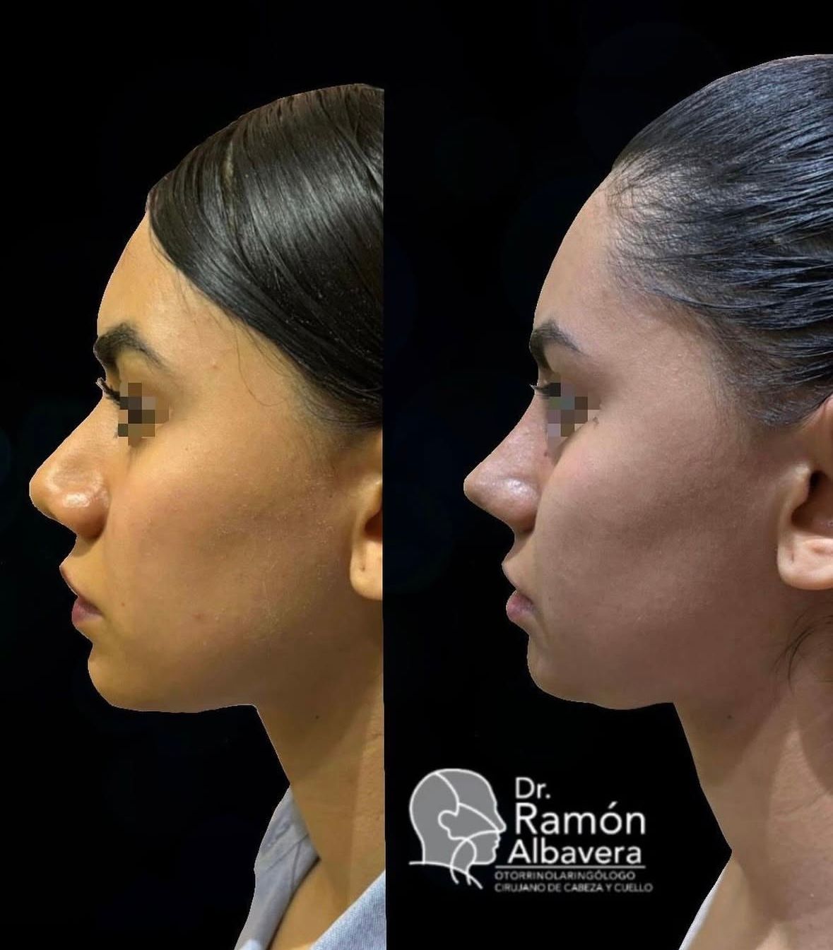 Luis Ramón Albavera Giles-1