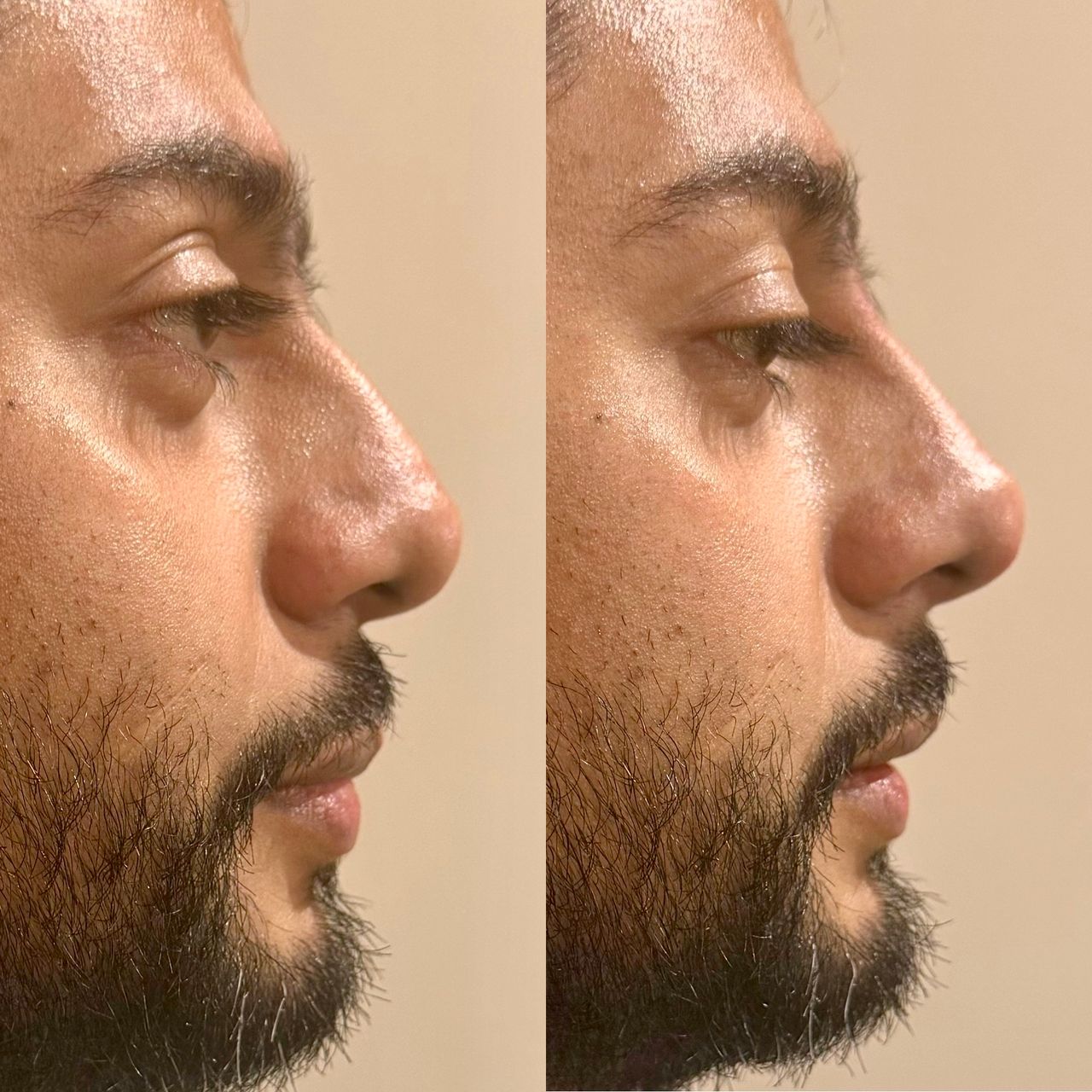 Anuar Hernández Flores-13