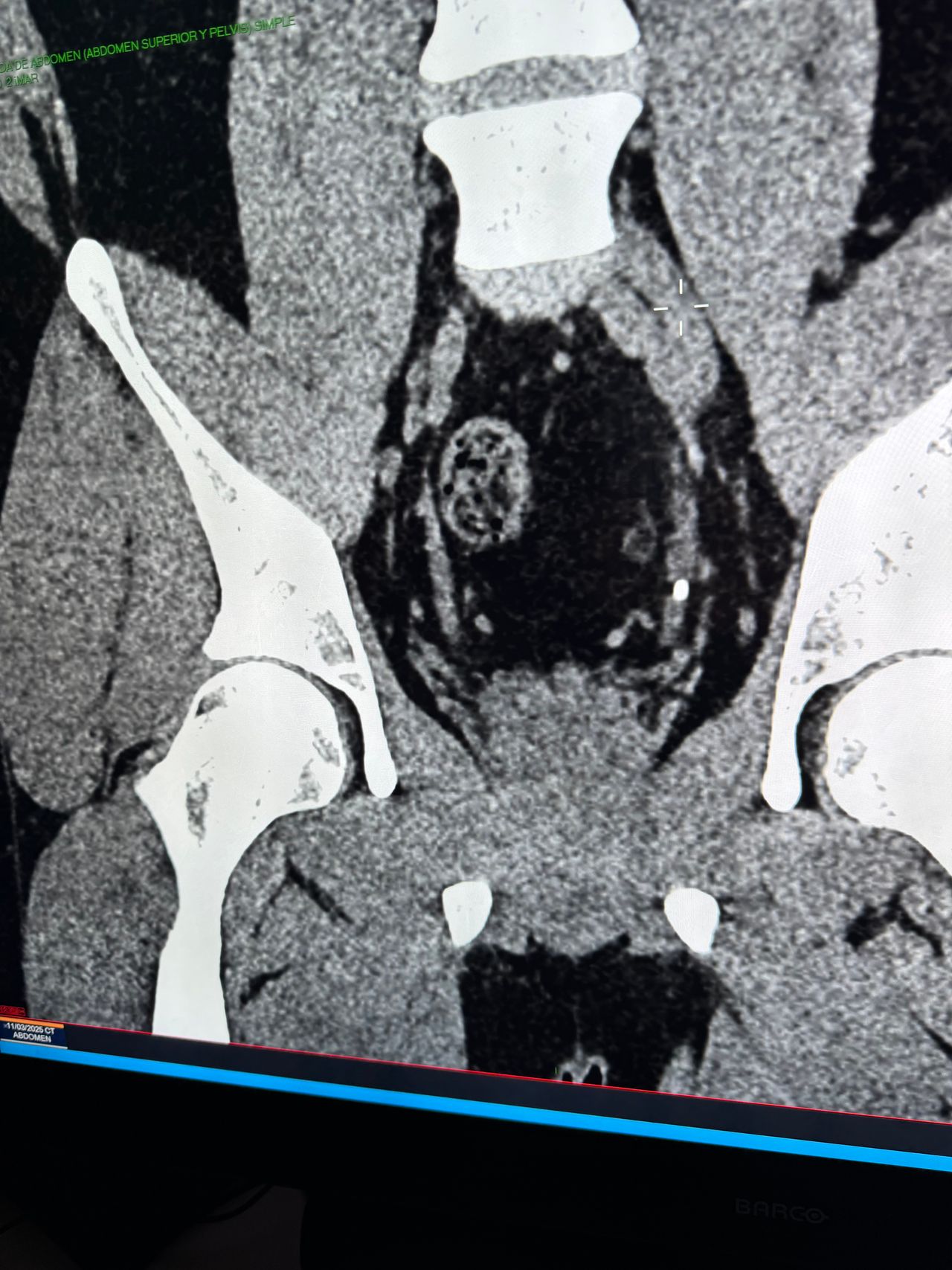 Carlos Erik Shuck Bello-16