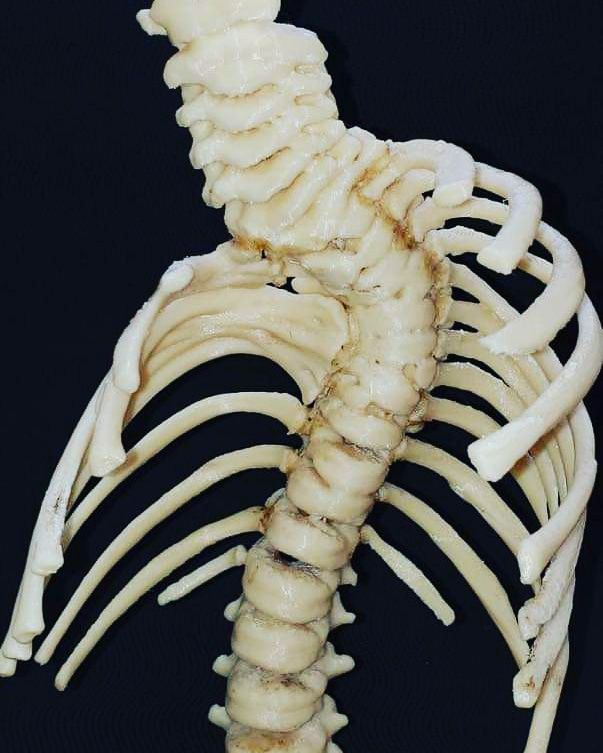 Alfonso Meza Vernis-83