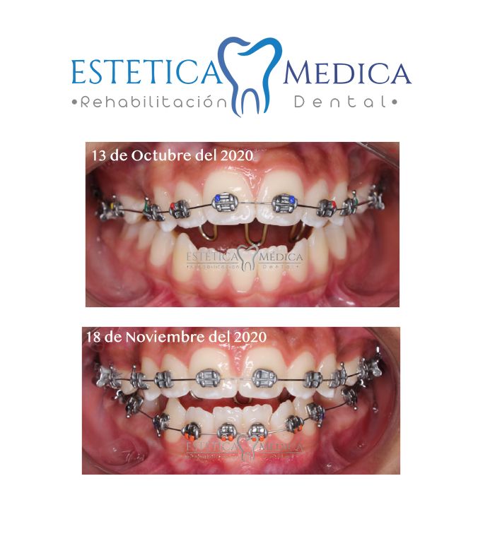 Bielmy Veronica Jonapa Peña-15