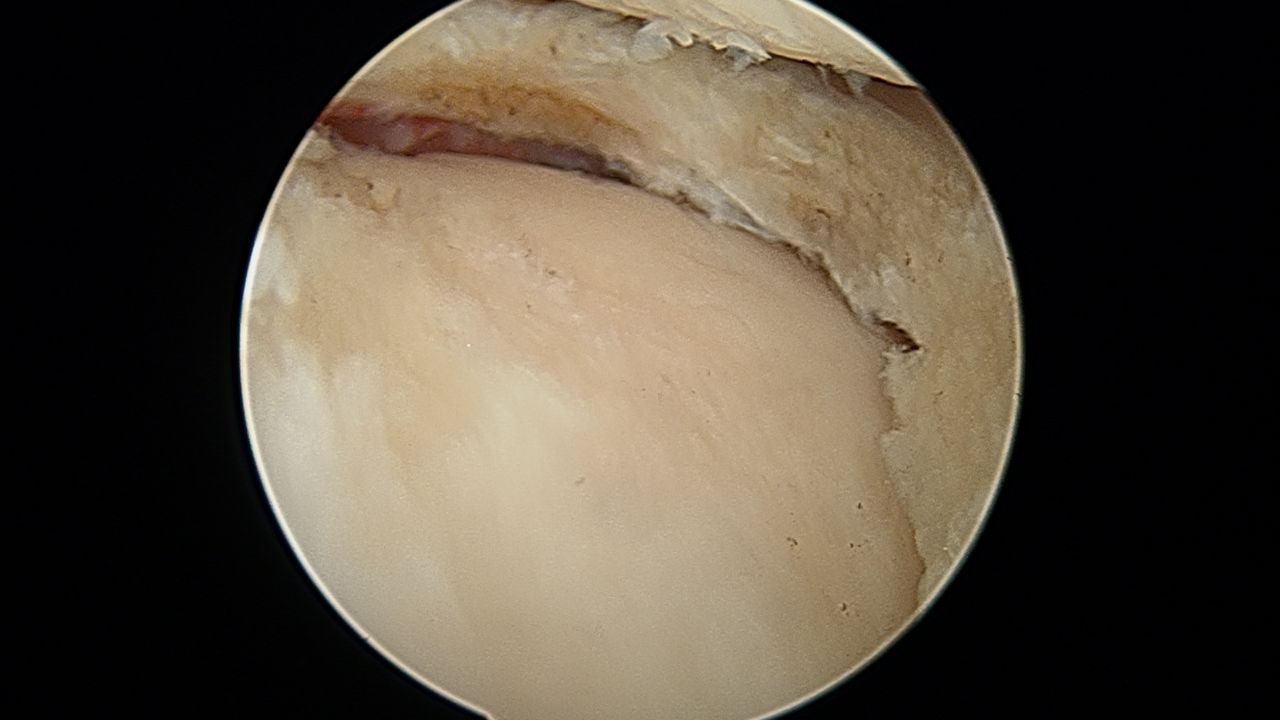 José Antonio Algarín Reyes-32