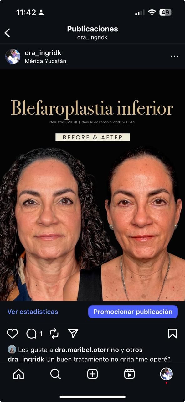 Ingrid Karely Chi-16