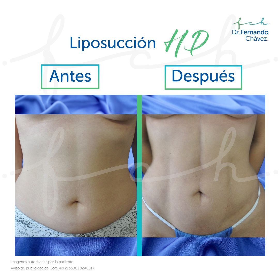 Fernando Chávez Osorio-27