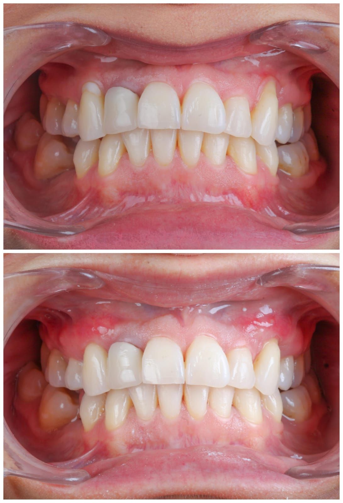 Hugo Enrique Aguilar Lamas-44