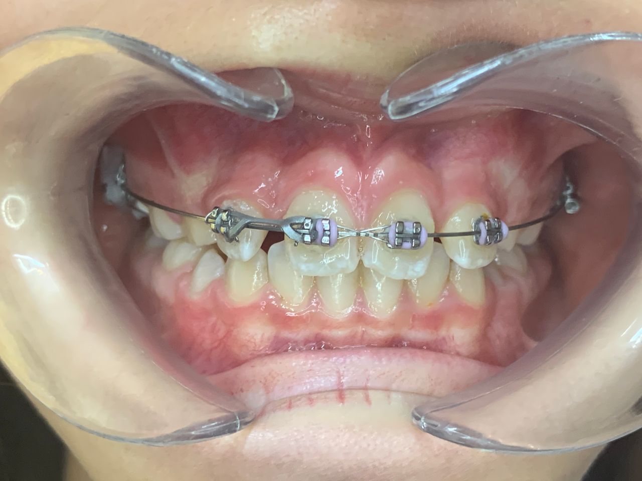 Patricia Rizo Palos-26