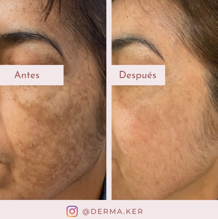 Karina Escobar Ramírez-10