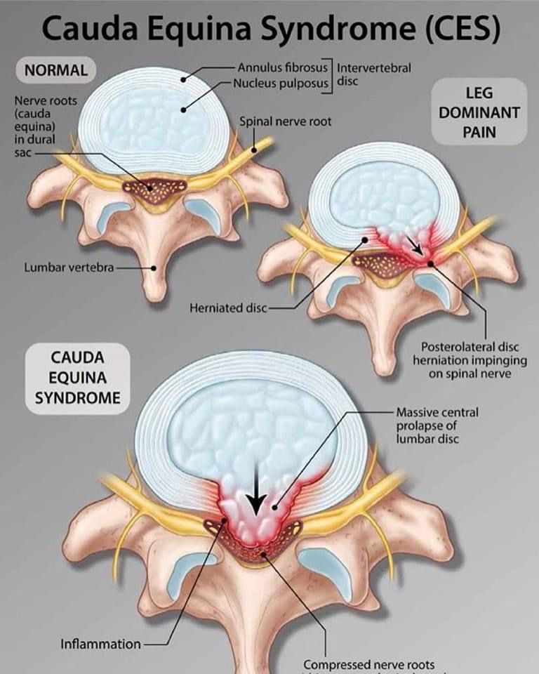 Michelle Omar Calderon Sánchez-8