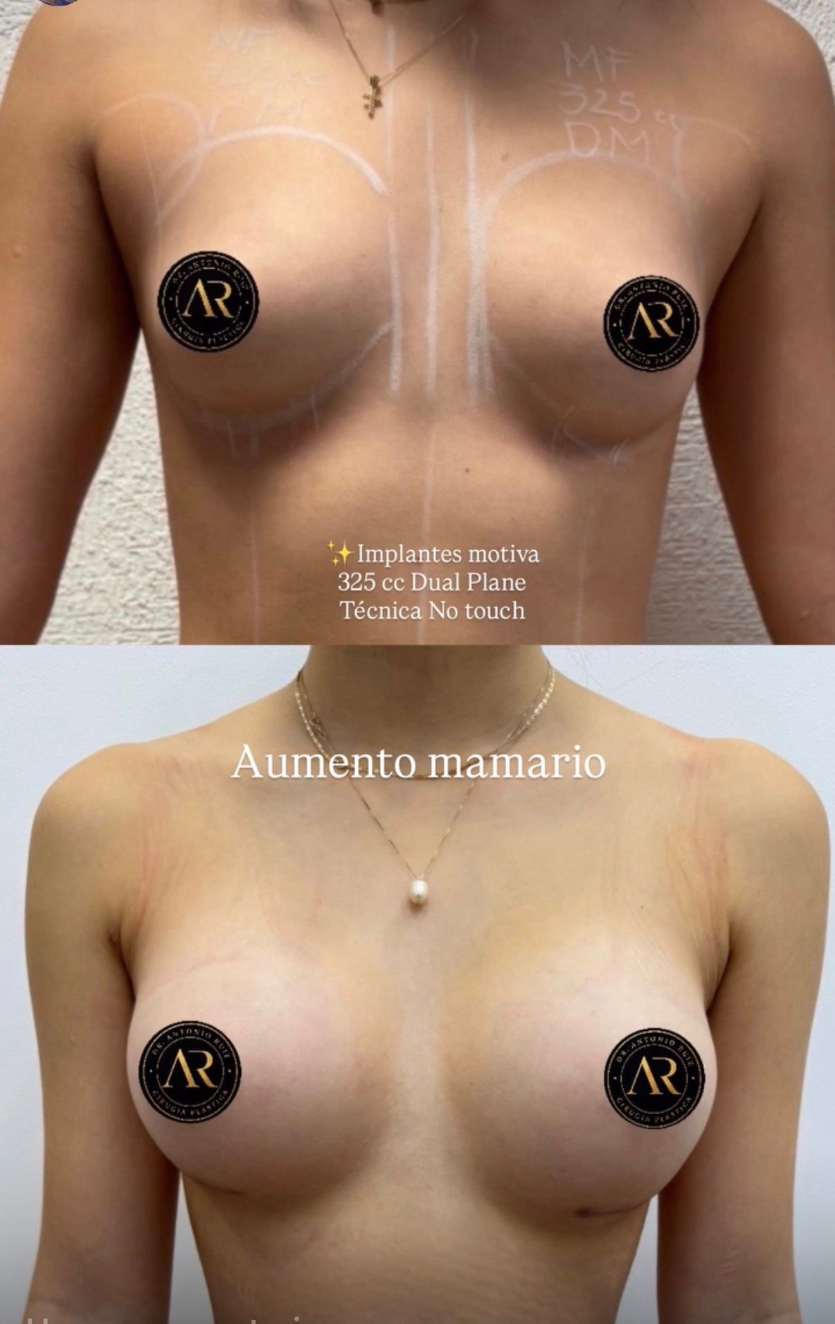 Antonio Ruiz Fernandez-10