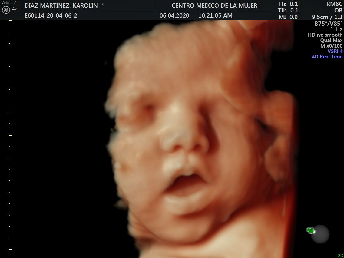 Julio Cesar Monárrez Martín-26