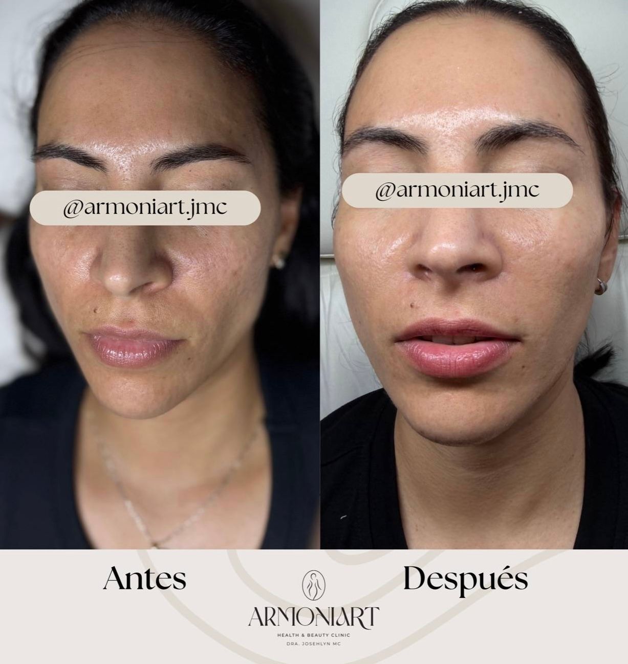 Josehlyn Martínez Carrillo-2