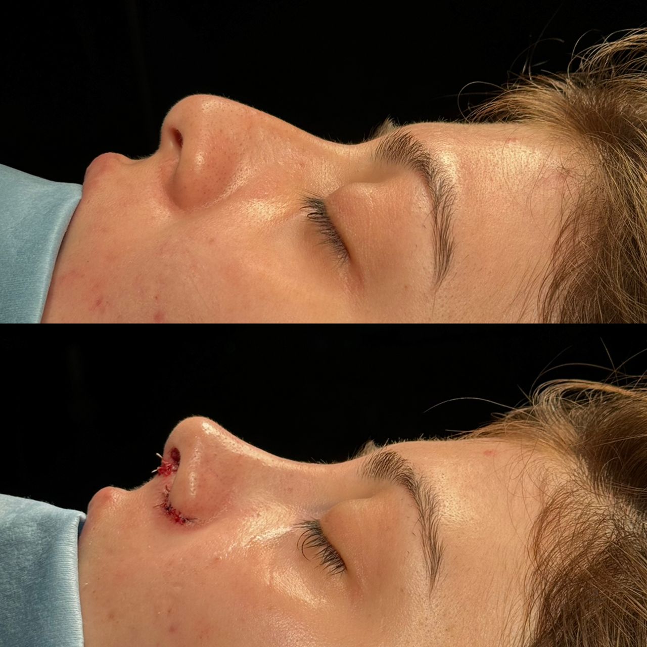 Angel Castro Urquizo-45