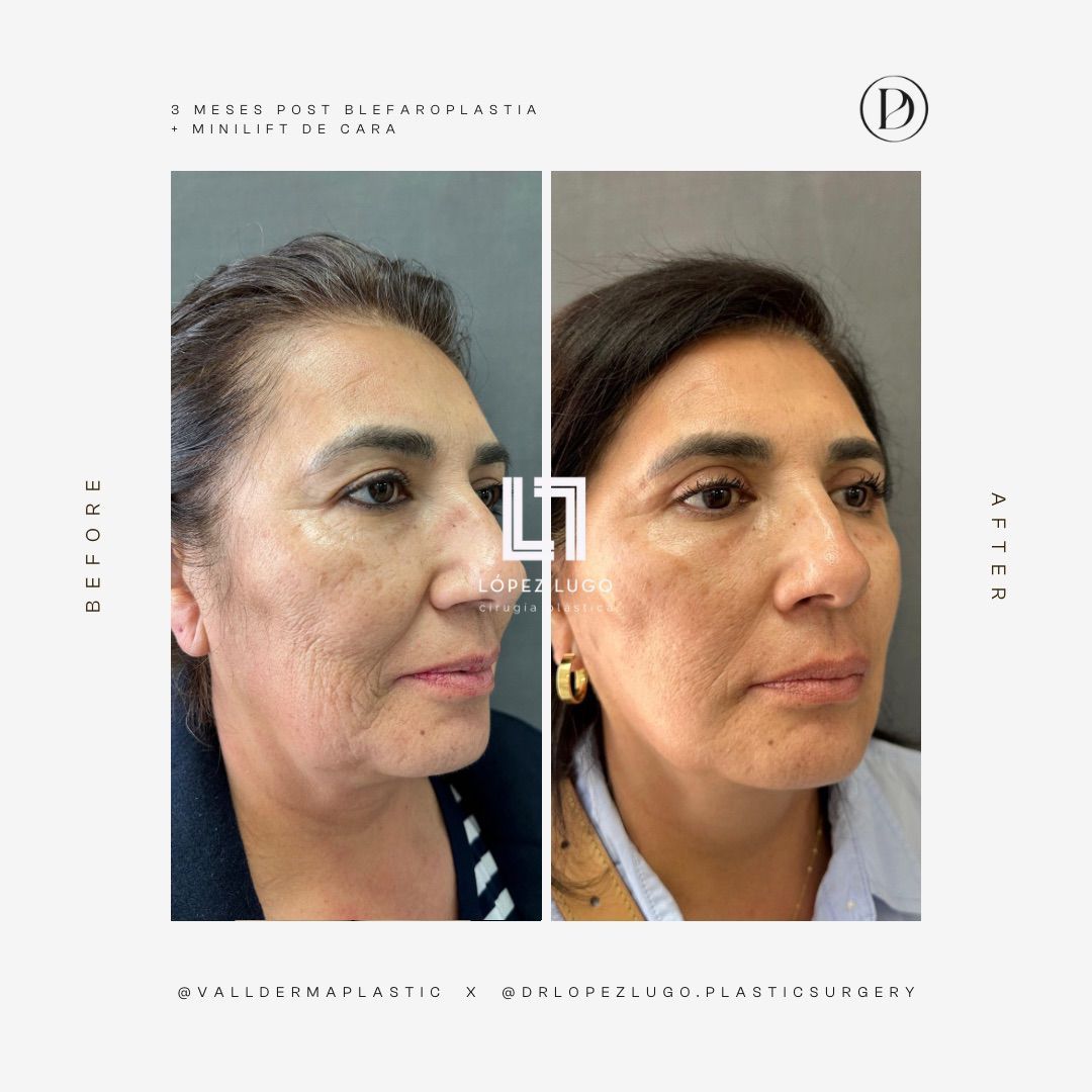 Omar Federico López Lugo-22