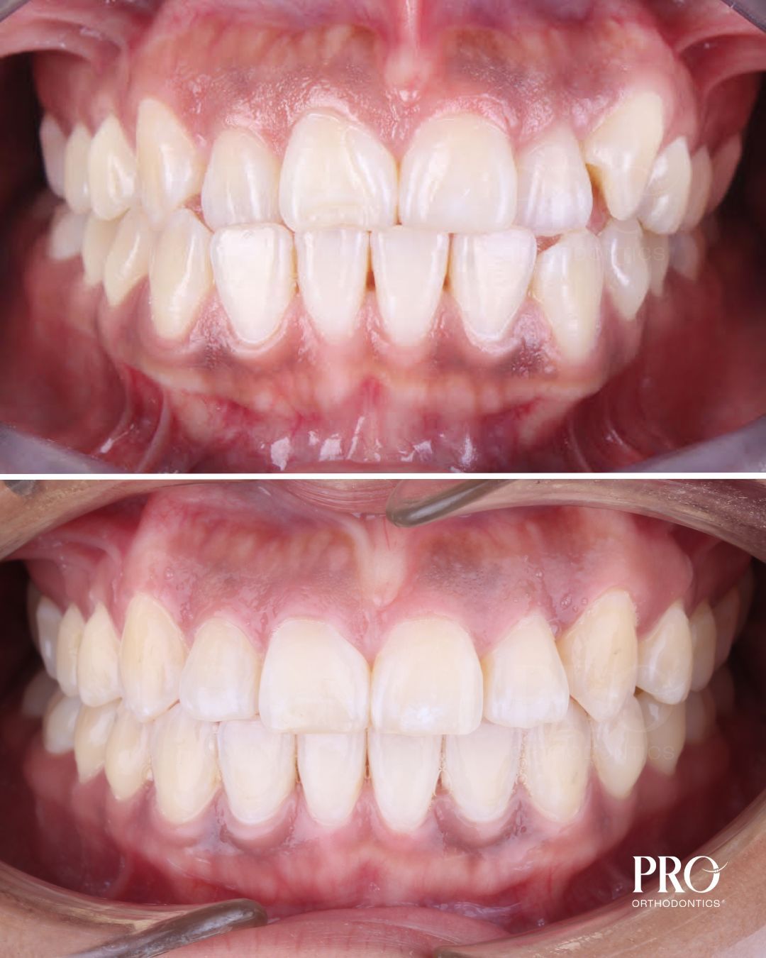 Verail Ruacho-6