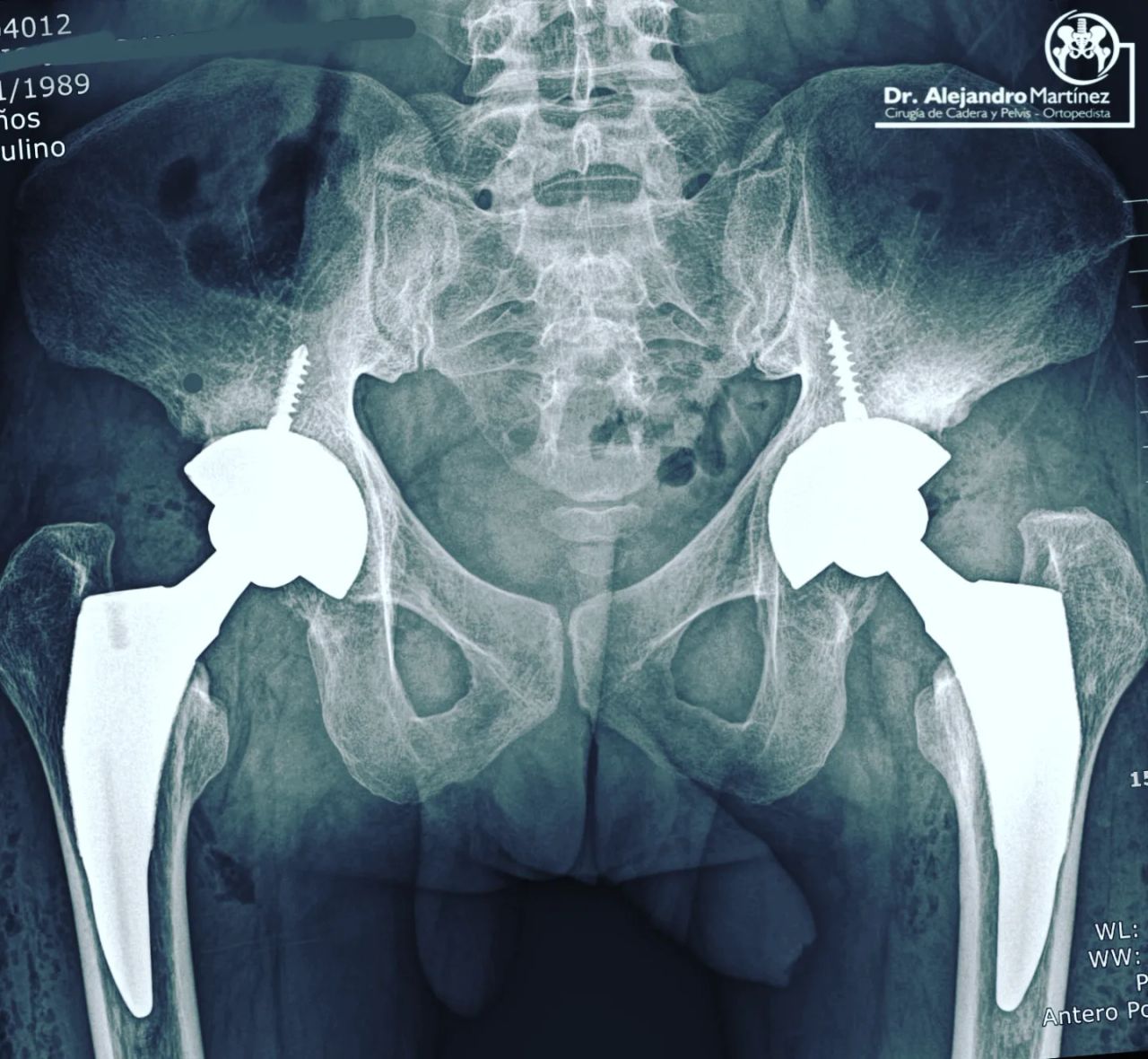 Alejandro Martínez Ramírez-29