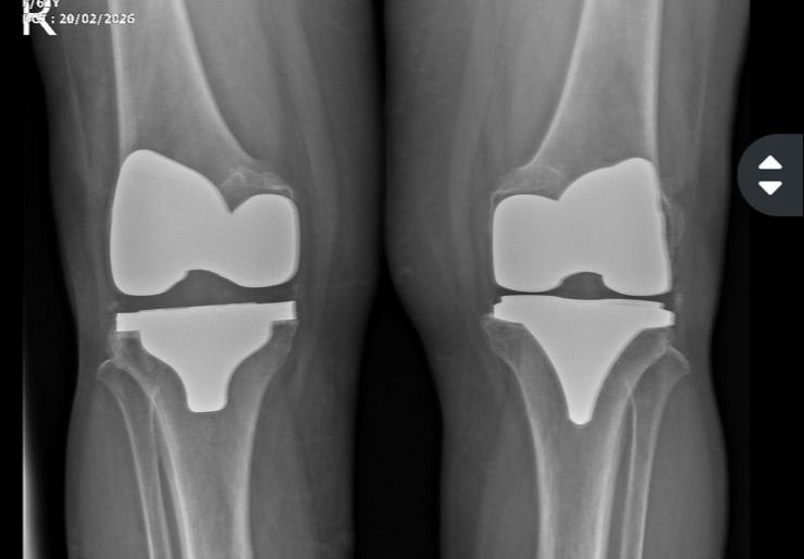 Silvano Ochoa Diaz-10