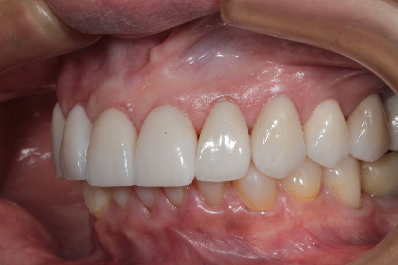 Mariel Itzayani Torres López-42